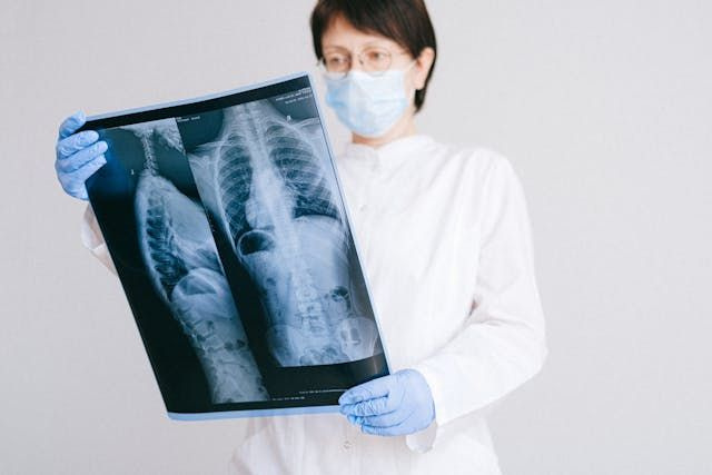 radiographer looks at X-ray scan