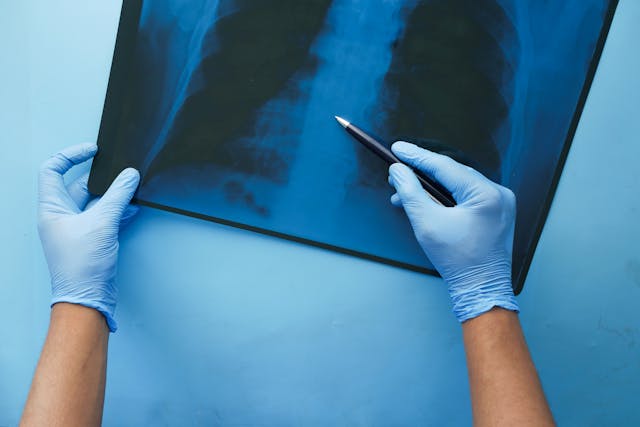Radiographer checking scan